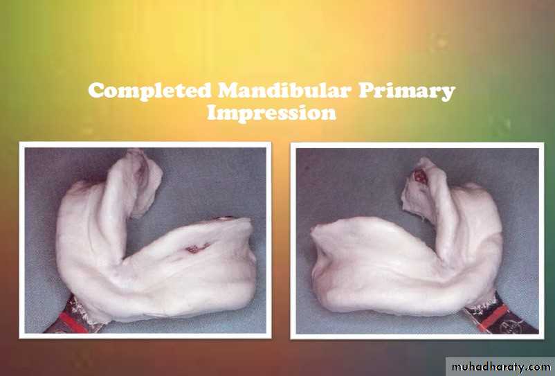 impression