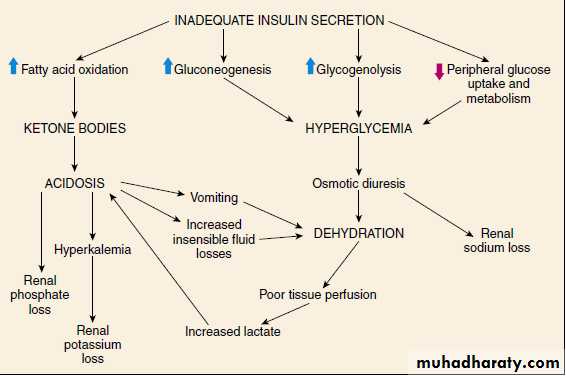 Diabetes mellitus in children