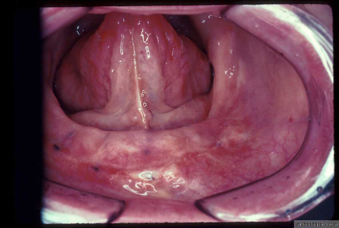 anatomically landmark of mandibular arch