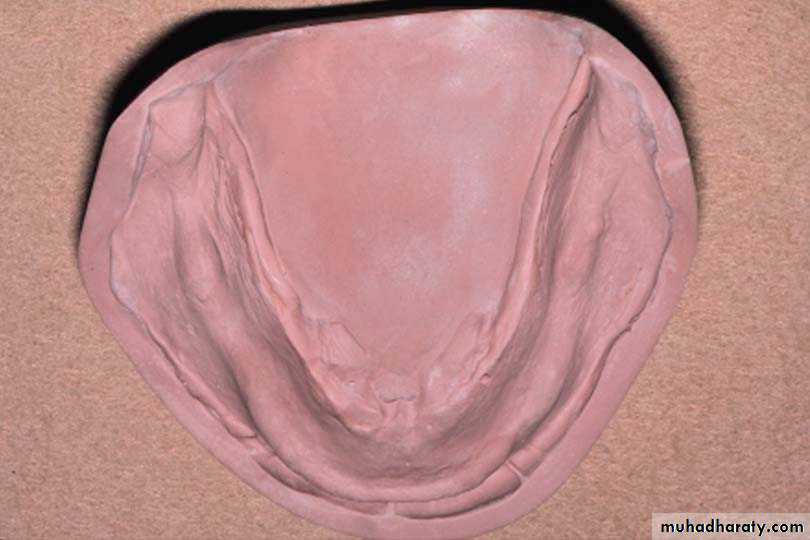anatomically landmark of mandibular arch