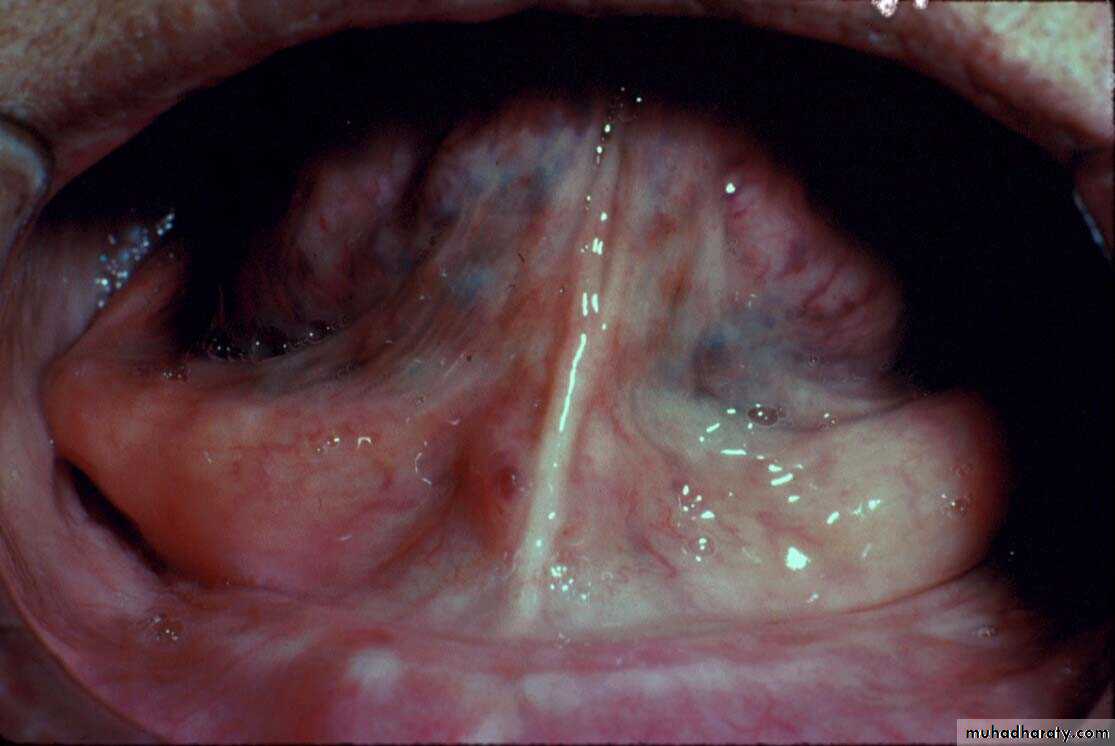 anatomically landmark of mandibular arch
