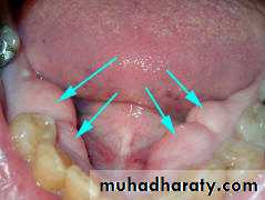 anatomically landmark of mandibular arch