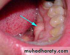 anatomically landmark of mandibular arch