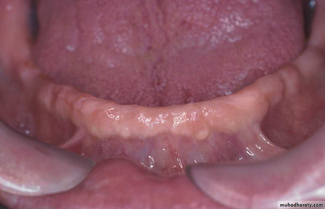 anatomically landmark of mandibular arch
