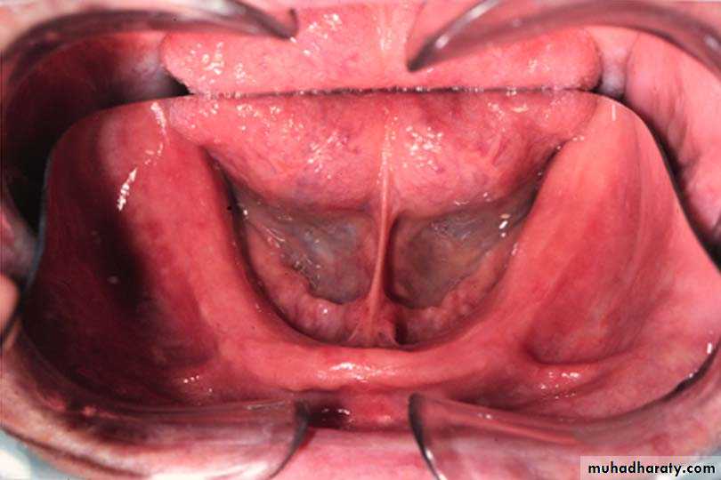 anatomically landmark of mandibular arch