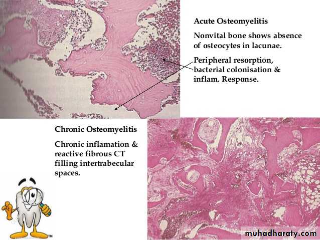 periapical pathology