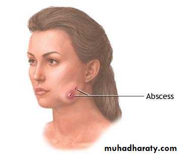 periapical pathology