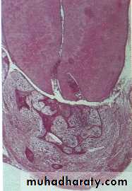 periapical pathology