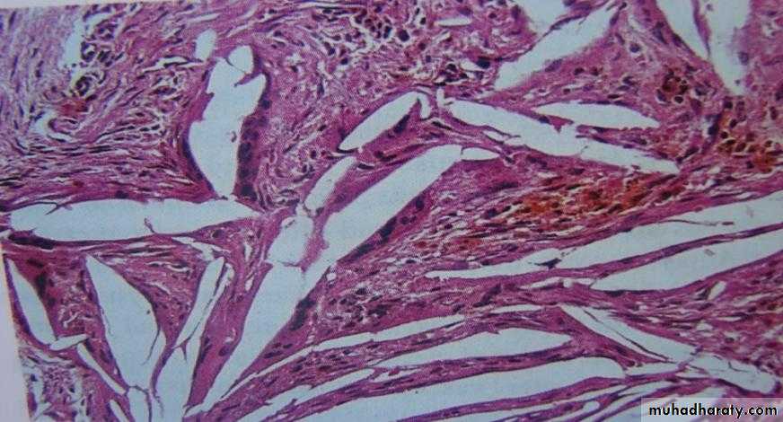 periapical pathology