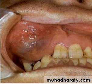 periapical pathology