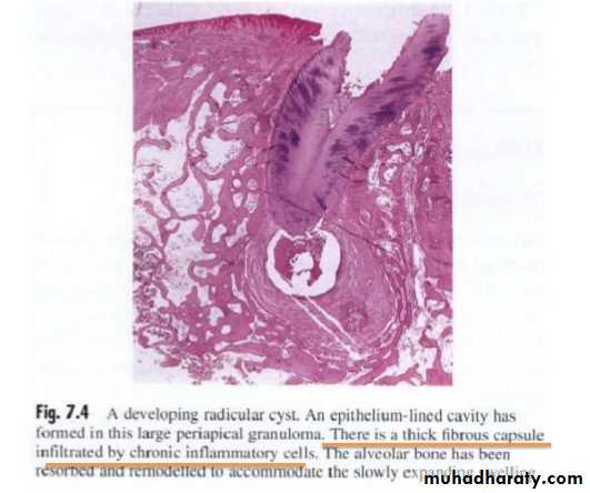 periapical pathology