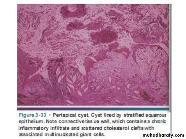 periapical pathology