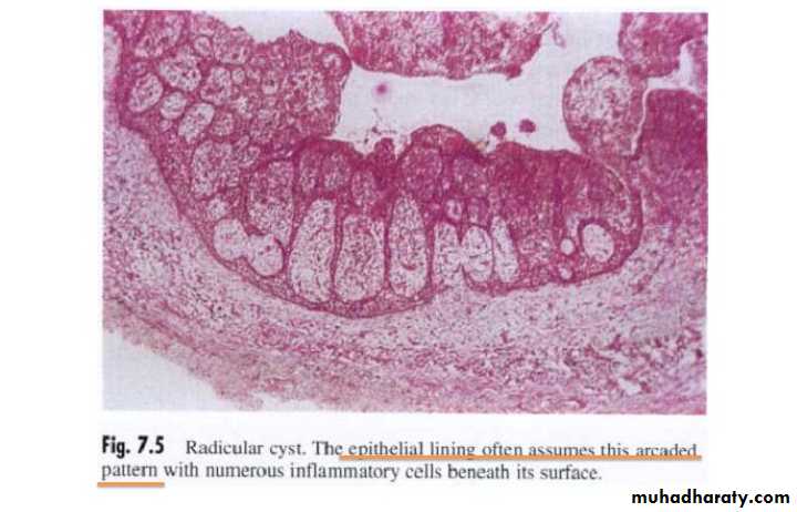 periapical pathology