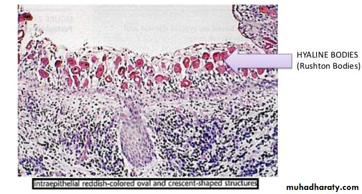 periapical pathology