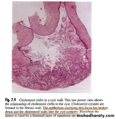 periapical pathology