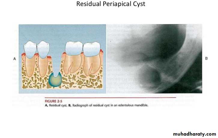 periapical pathology