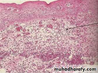 periapical pathology