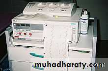 fetal monitor