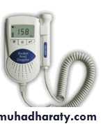 fetal monitor