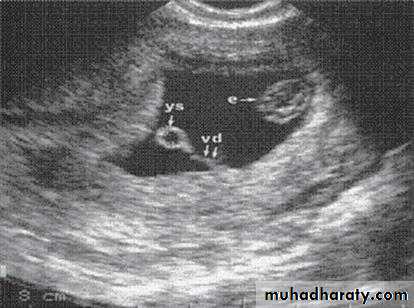 fetal monitor