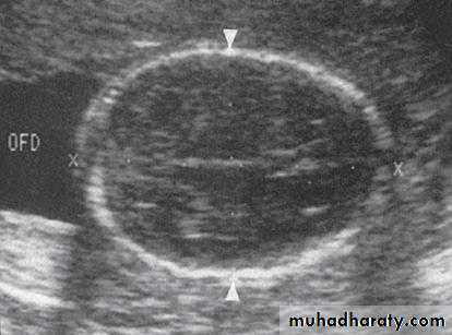 fetal monitor