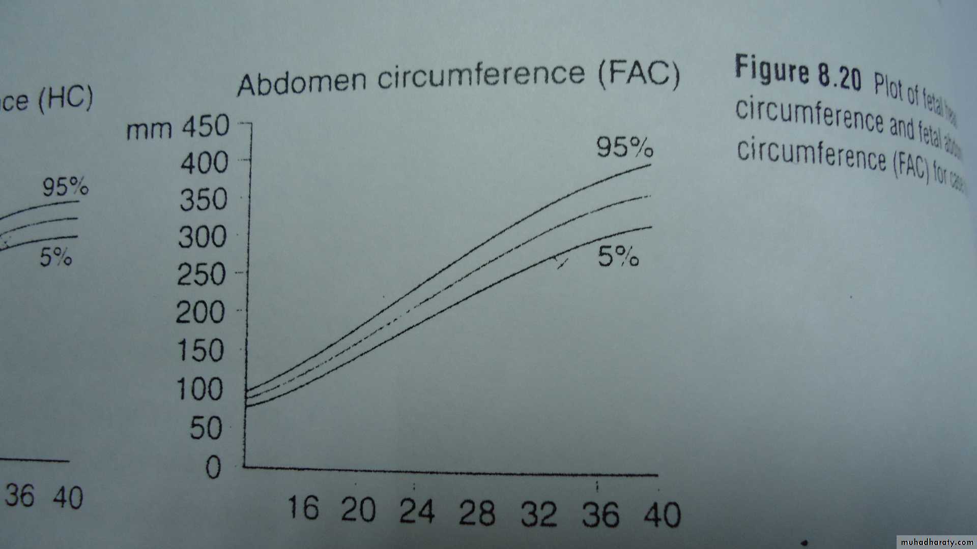 fetal monitor