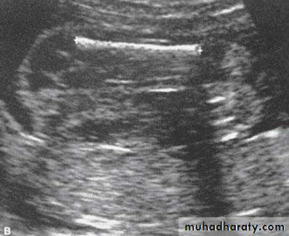 fetal monitor