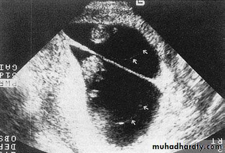 fetal monitor