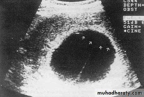 fetal monitor