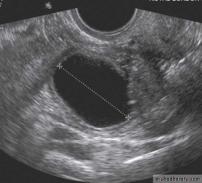 female genital tract 1 ppt