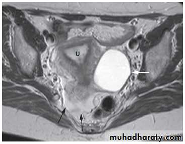 female genital tract 1 ppt