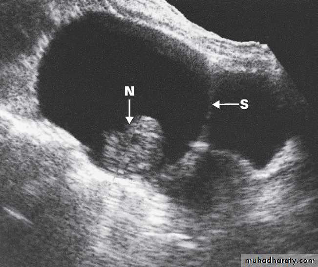 female genital tract 1 ppt
