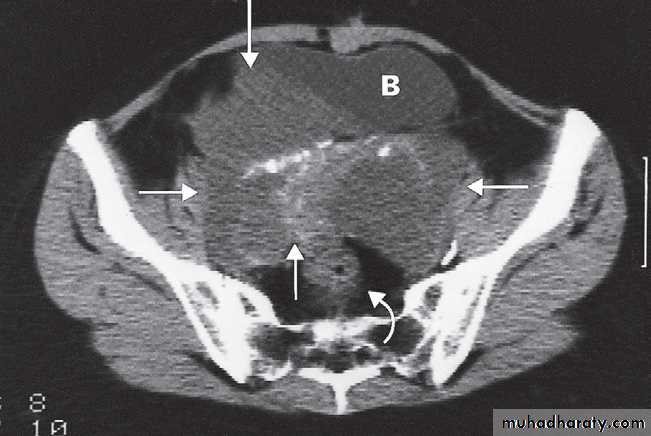 female genital tract 1 ppt