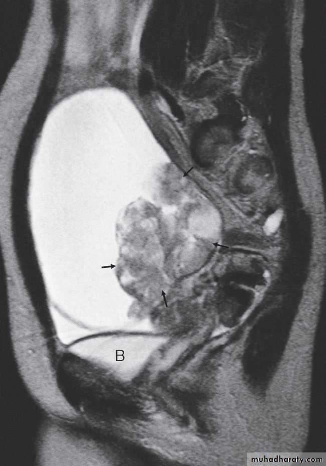 female genital tract 1 ppt
