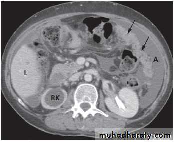 female genital tract 1 ppt