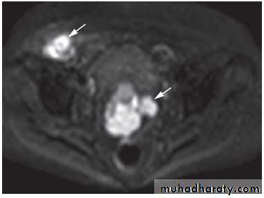female genital tract 1 ppt
