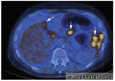 female genital tract 1 ppt