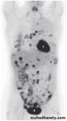 female genital tract 1 ppt