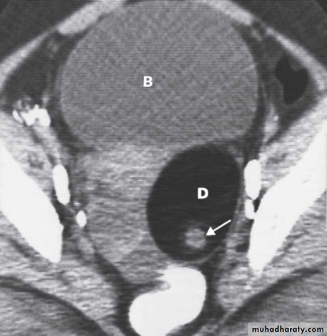 female genital tract 1 ppt