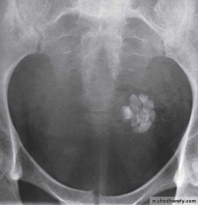 female genital tract 1 ppt