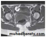 female genital tract 1 ppt