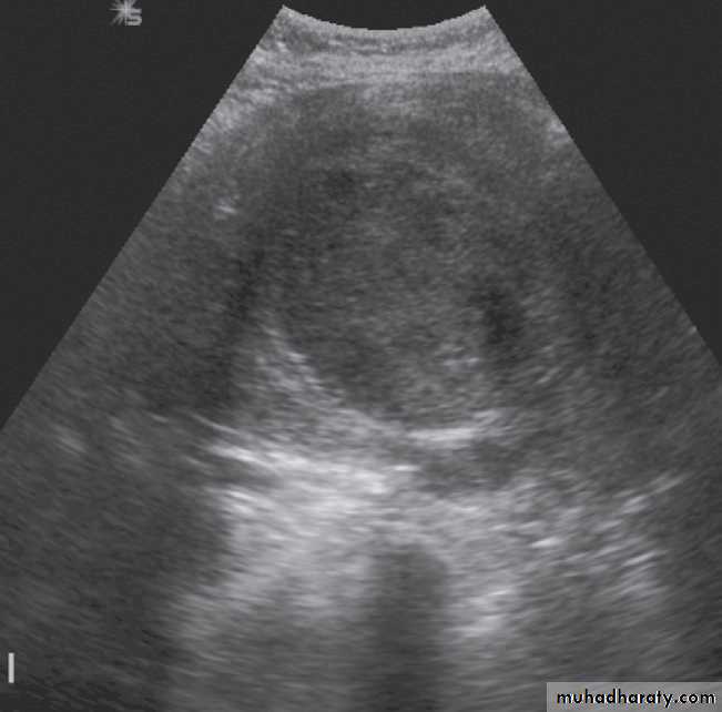female genital tract 1 ppt