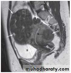 female genital tract 1 ppt