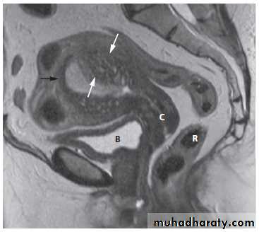 female genital tract 1 ppt