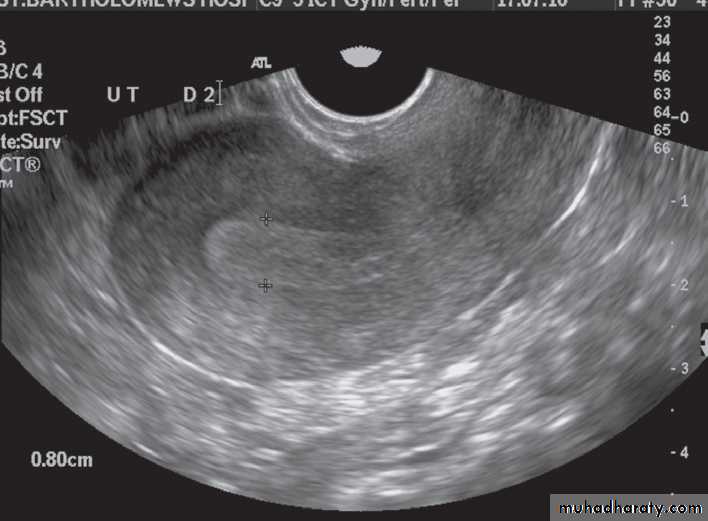 female genital tract 1 ppt