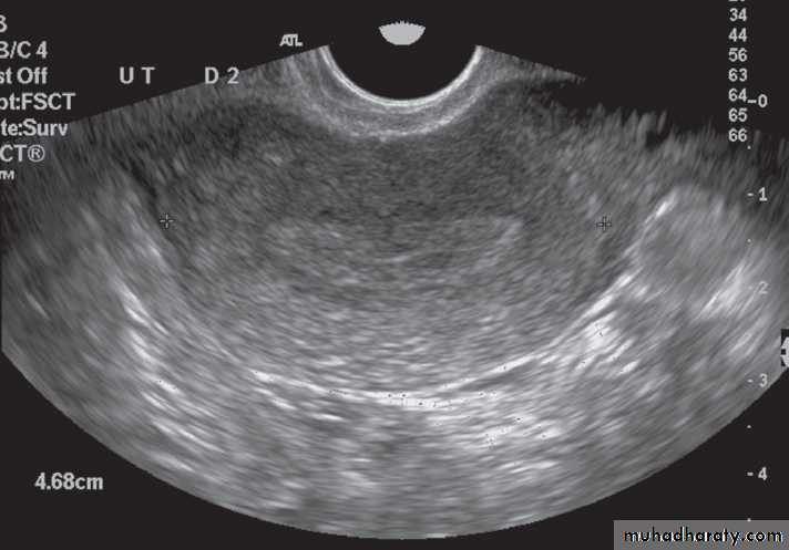 female genital tract 1 ppt