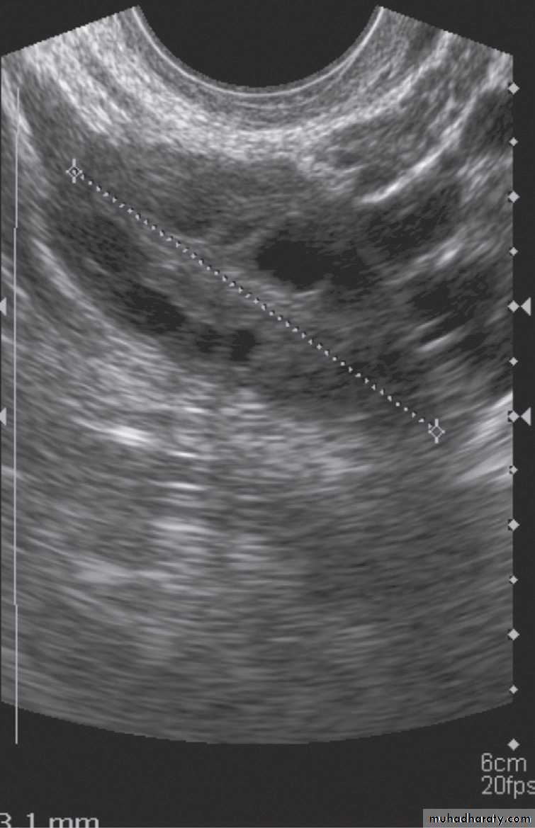 female genital tract 1 ppt