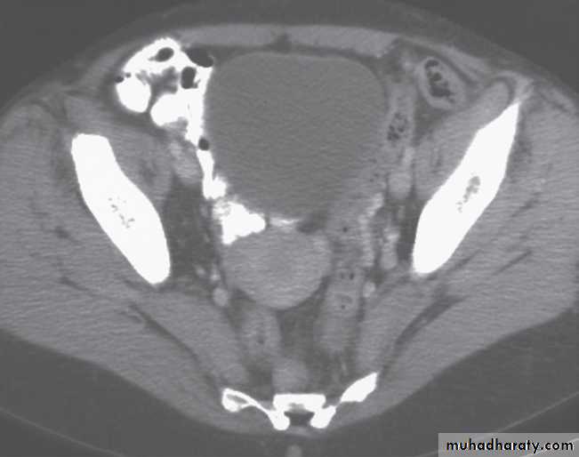 female genital tract 1 ppt