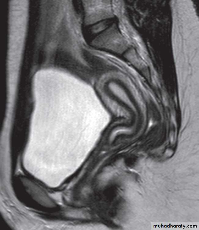 female genital tract 1 ppt