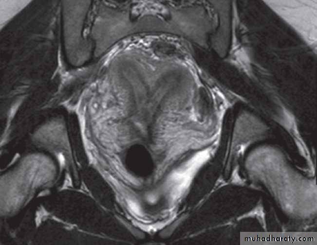 female genital tract 1 ppt